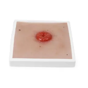 Wound Moulage Colostoma, incl. Stand