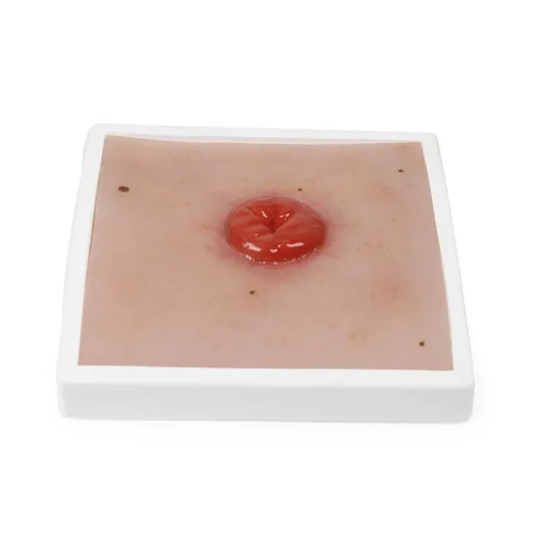 Wound Moulage Colostoma, incl. Stand